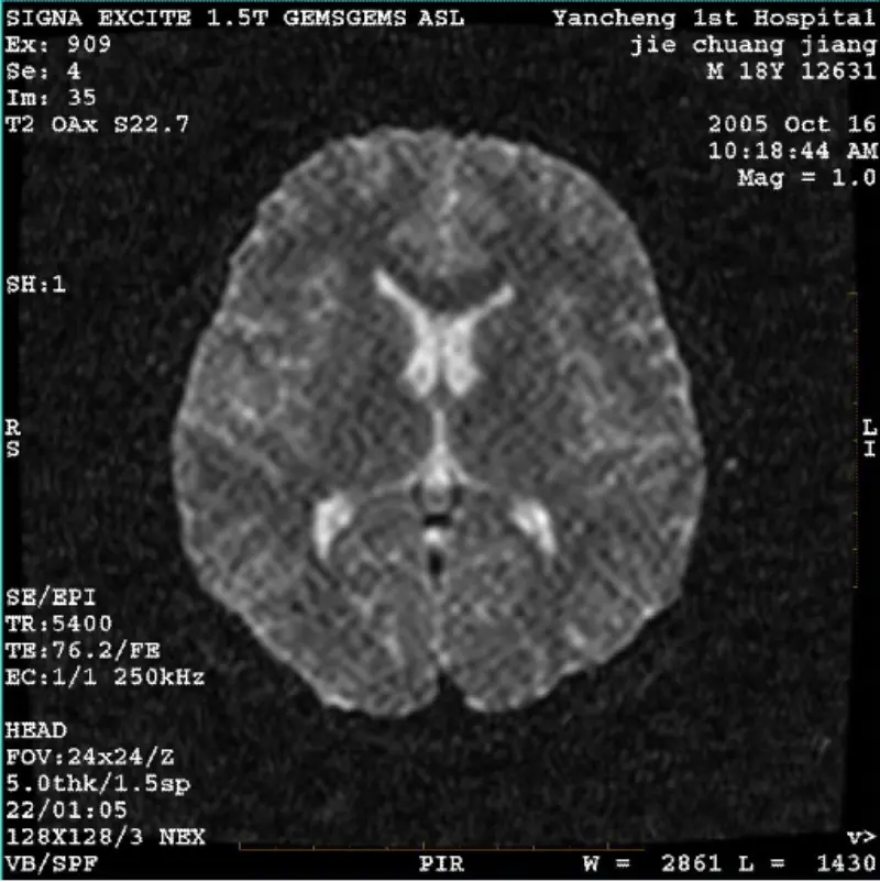 ຮູບພາບ ARTIFACT WI/Fiesta ສີຂາວ Pixel